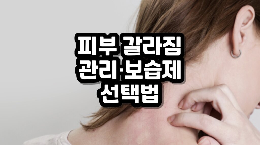 피부 갈라짐