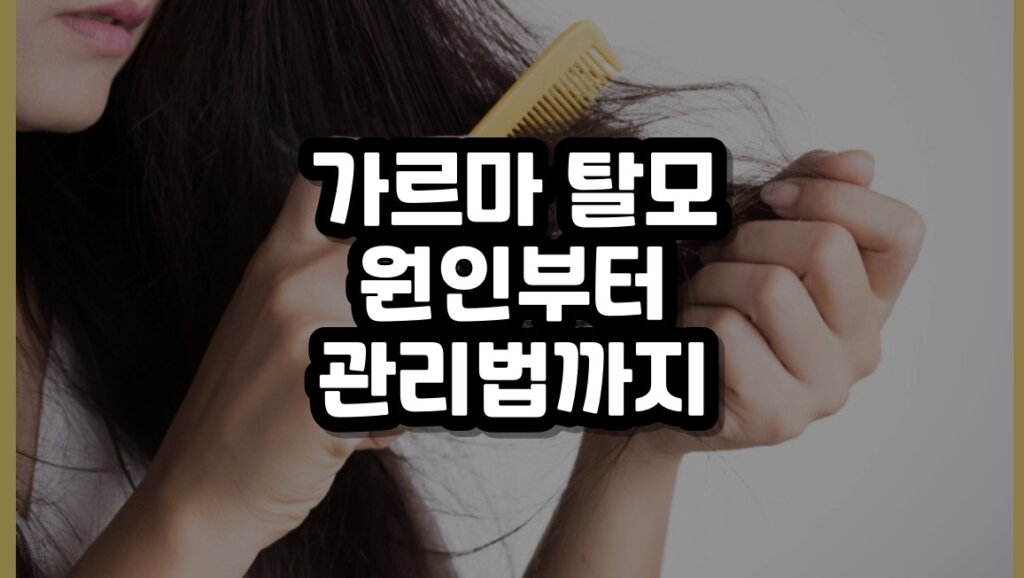가르마 탈모